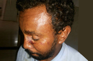المحامي محمد إبراهيم وعلى وجهه آثار الضرب (صورة سودان تربيون)