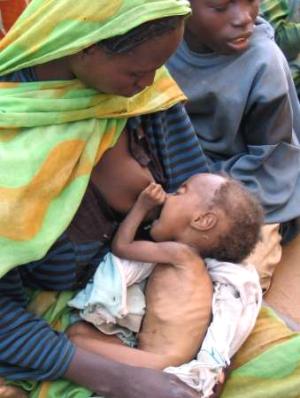 Sudanese_refugee_mother_breastfeeds_her_malnourished_child_20040618.jpg