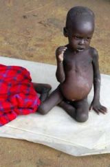 malnourished_Sudanese_child.jpg