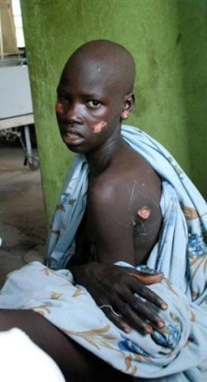 Sudanese girl who was injured during August 2 attack near Akobo on Lou Nuer receiving treatment at a hospital in the state of Jonglei on August 7 (AFP)