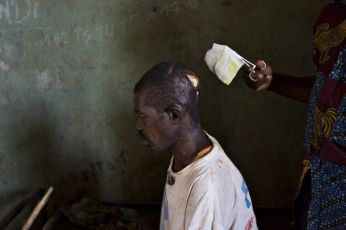 A nurse dresses the machete wounds on the head of Jean-Marie Anigbishe, 45, who was attacked by Ugandan LRA rebels near Ngalima in northeastern Congo February 21, 2009