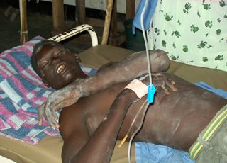 John Akech, who was injured in the accident on November 12, lies on bed in Bor civil hospital (ST)