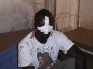 Malual Akochok on bed at Bor Civil Hospital after he was shot in the nose by celebratory gunfire after the announcement of South Sudan's imminent independence. Feb 8, 2011 (ST)