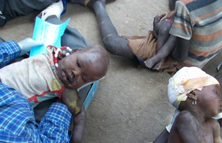 Injured children from Wek village, Uror county,  January 12, 2012