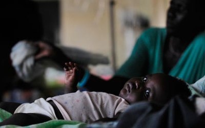 Malaria affected baby, Juba, South Sudan (Getty)