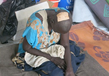 A blind elderly Shilluk woman who was beaten by opposition fighters, pictured in Upper Nile state's Malakal hospital in February 2014 (Photo: Donatella Rovera for Amnesty International)