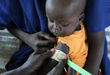 A South Sudanese boy has a MUAC test, designed to detect malnutrition (Photo: ACF-South Sudan/T. Frank)