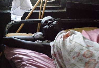 A south Sudanese man recovers from the kala azar disease (File photo AFP)