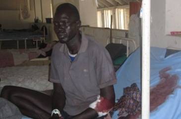 Mayom Achiek Deng recovers in hospital after being injured in an attack on Bor county's Tibek on 16 February 2015 (ST)