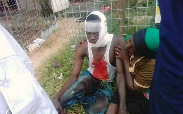 A resident of Kalma camp wounded during the clashes with the government forces on 22 September 2017 (ST Photo)