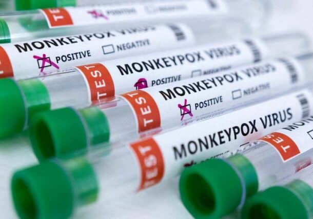 Monkeypox