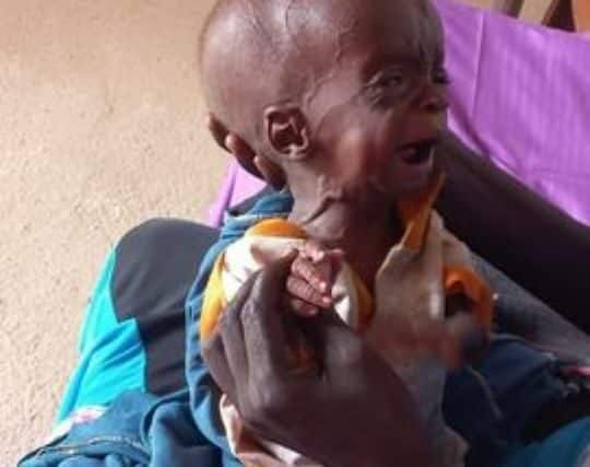 A mother holds her malnourished child at a dispensary in Zalingei photo released by Darfur displaced and refugee coordination on August 7, 2024-1jpg