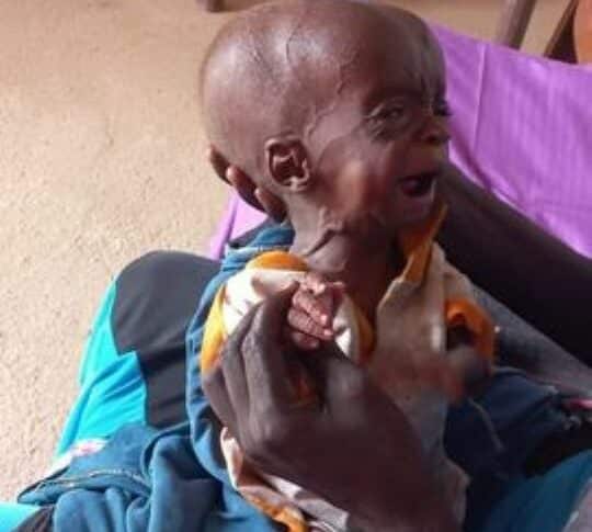A mother holds her malnourished child at a dispensary in Zalingei photo released by Darfur displaced and refugee coordination on August 7, 2024-1jpg