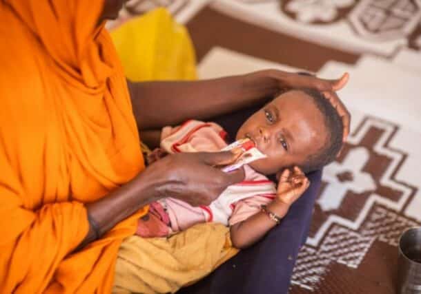 A child receives a life-saving therapeutic food treatment UNICEF photo)