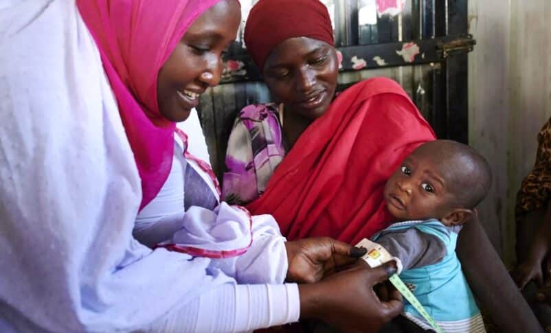 Malnutrition killed 29 child in Western Omdurman, a local group said on Dec 8, 2024 UNICEF photo