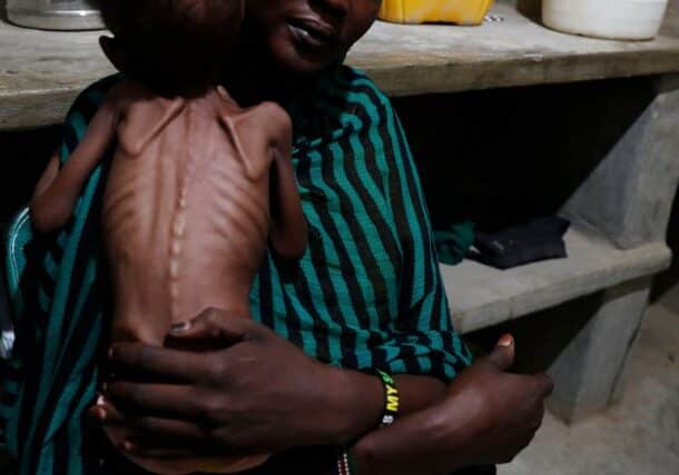 A mother holds her severely malnourished child at the Mother of Mercy Hospital in Sudan's South Kordofan state. Reuters photo
