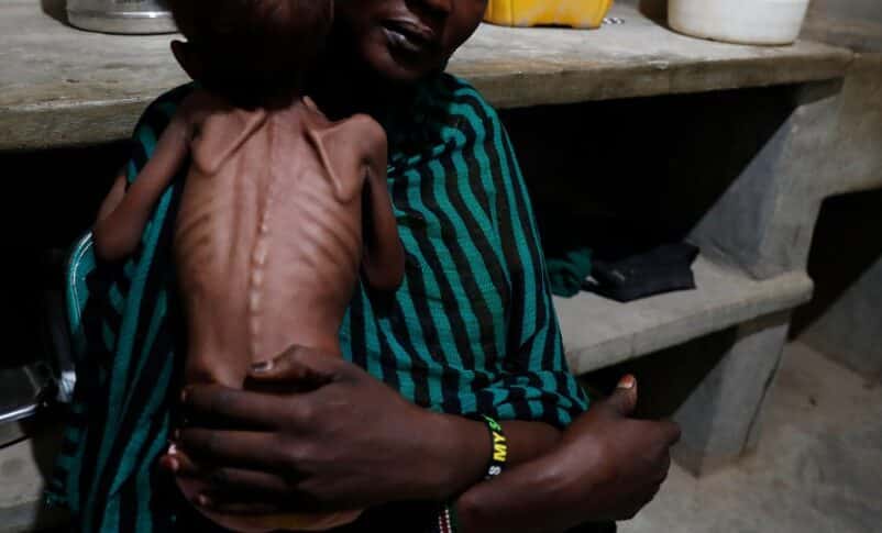 A mother holds her severely malnourished child at the Mother of Mercy Hospital in Sudan's South Kordofan state. Reuters photo