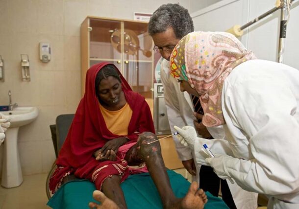 A file photo shows doctors examining a patient infected with mycetoma.