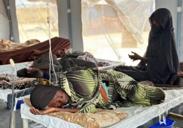 A patient with cholera receives treatment at an isolation ward in an IDP camp in Tawila, in Darfur region, August 12, 2025. AFP photo