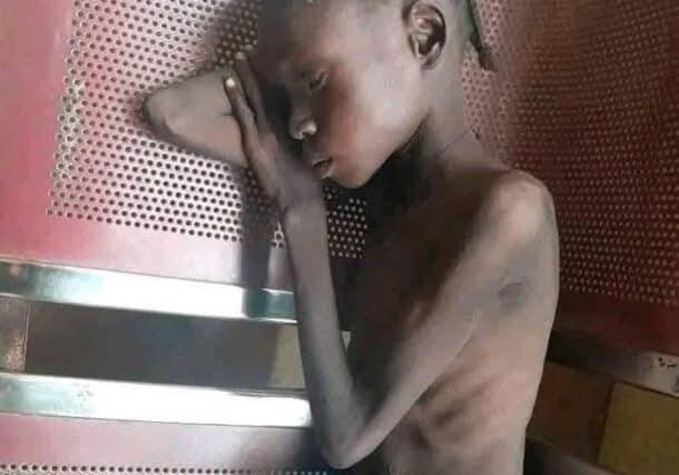 A photo released by activists on July 26, 2025, shows a malnourished girl in El Fasher, North Darfur.