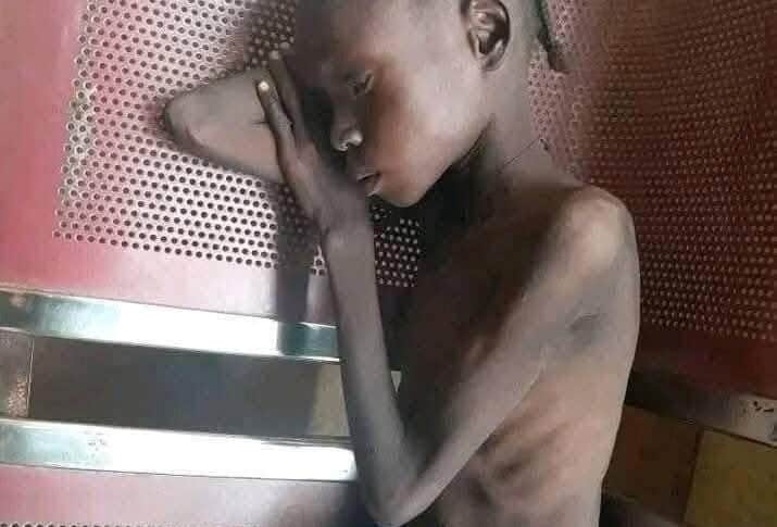 A photo released by activists on July 26, 2025, shows a malnourished girl in El Fasher, North Darfur.