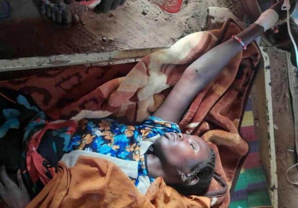 Malaria patient in Tawaila camp, on September 17, 2025