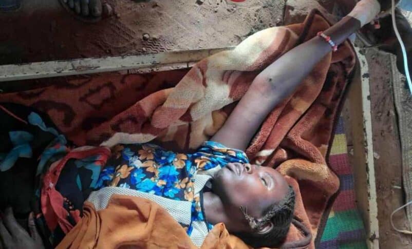 Malaria patient in Tawaila camp, on September 17, 2025